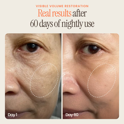 ZIVVI PDRN SERUM